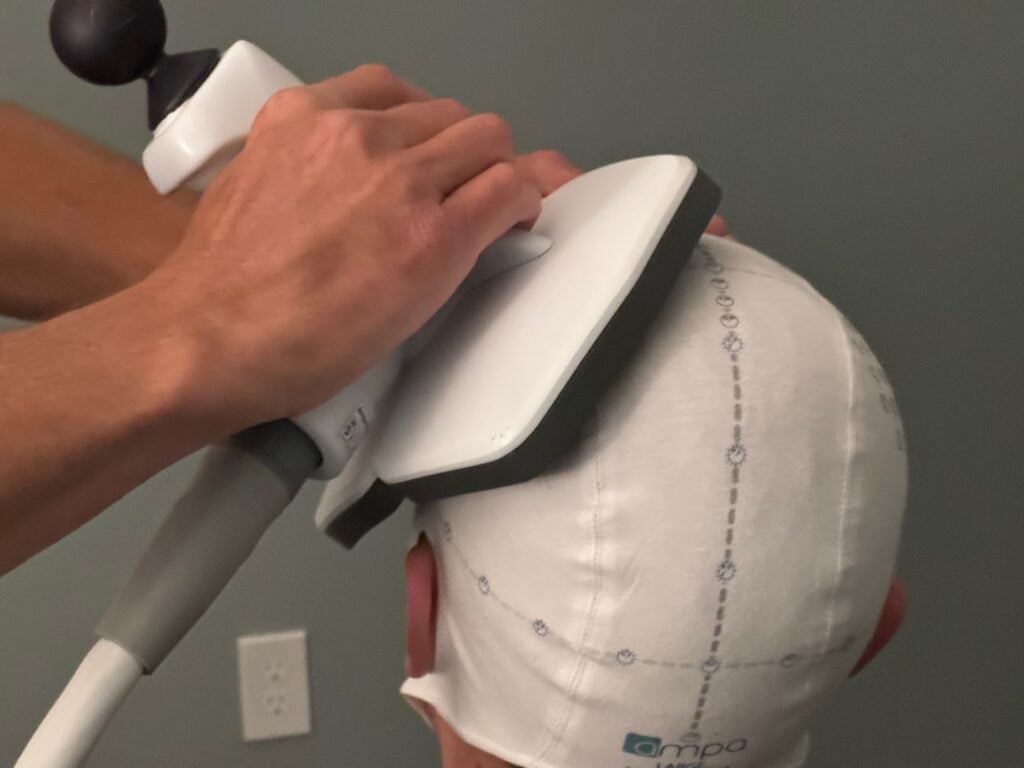 tms-for-anxiety